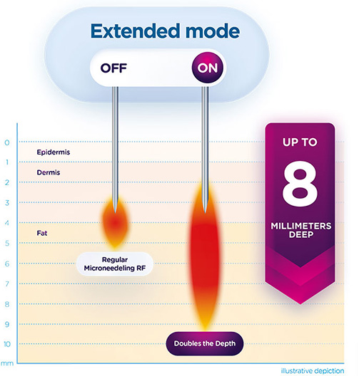 exion-extended-mode